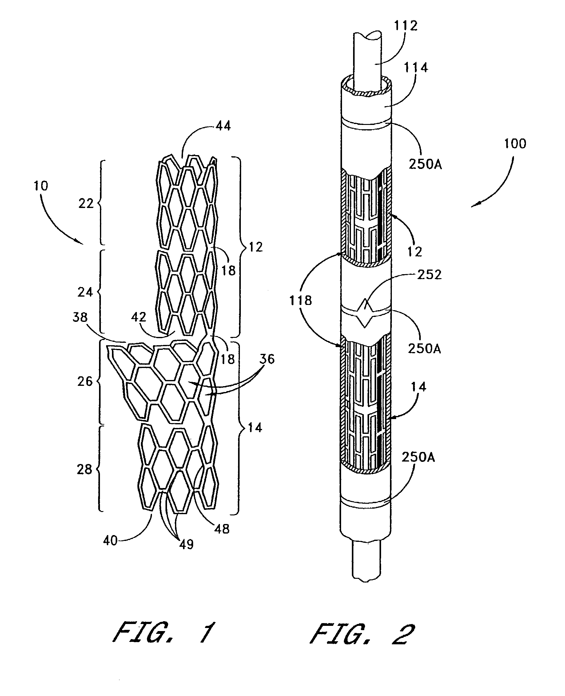 Noncylindrical stent deployment for treating vascular bifurcations