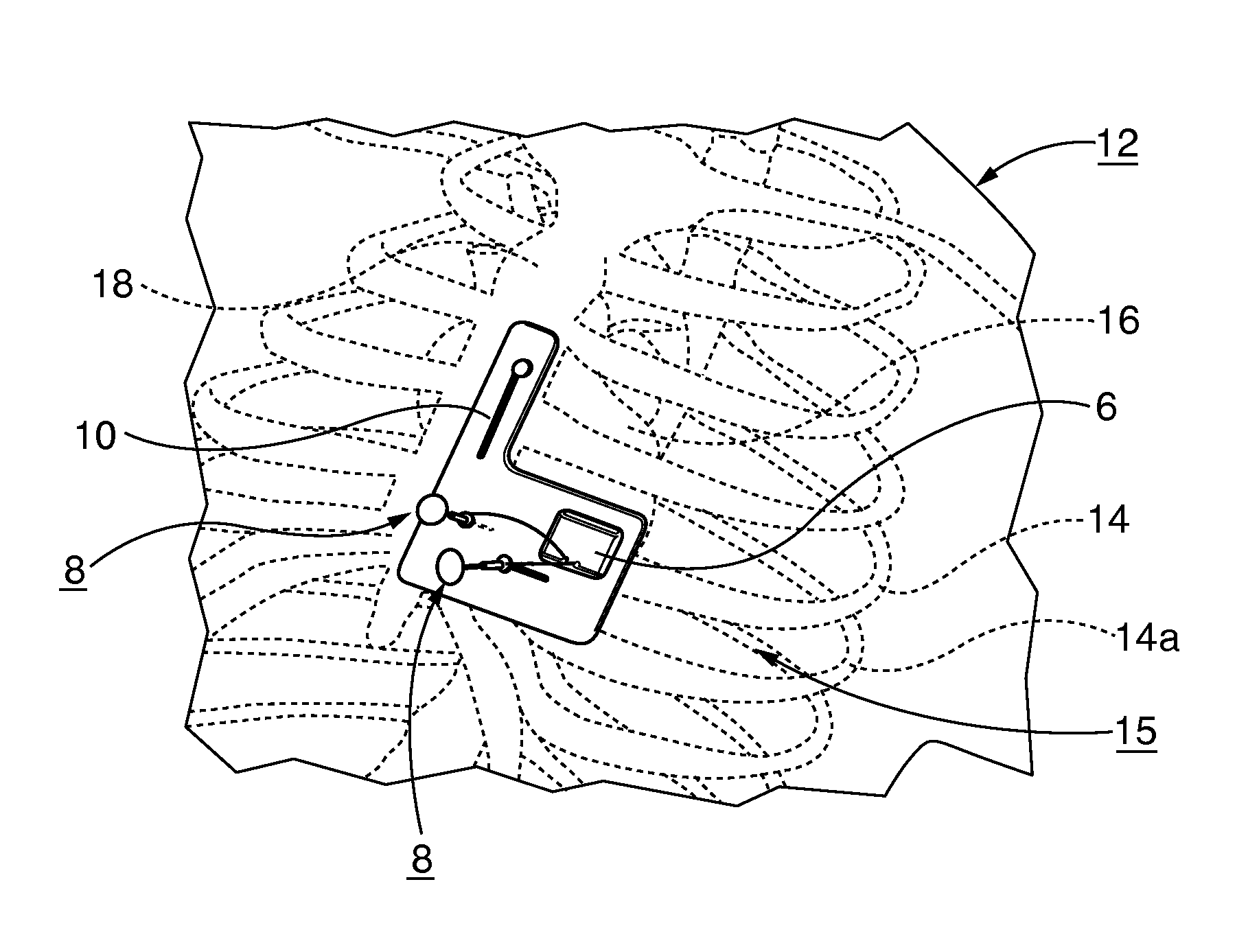 Battlefield defibrillation system