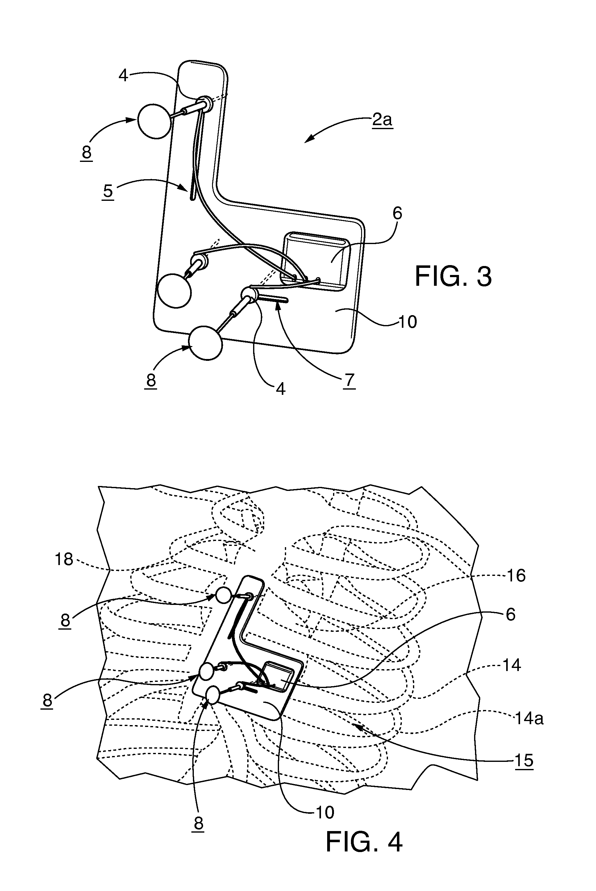 Battlefield defibrillation system