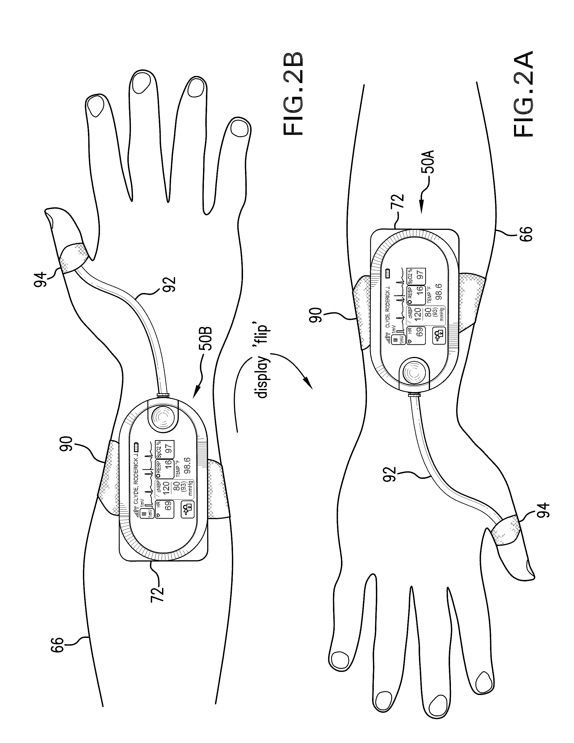 Body-worn vital sign monitor