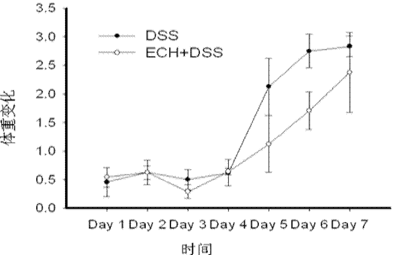 Application of echinacoside in preparation of medicine for treating inflammatory bowel disease