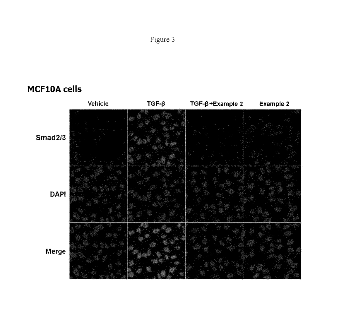 Methods of treating fibrosis, cancer and vascular injuries