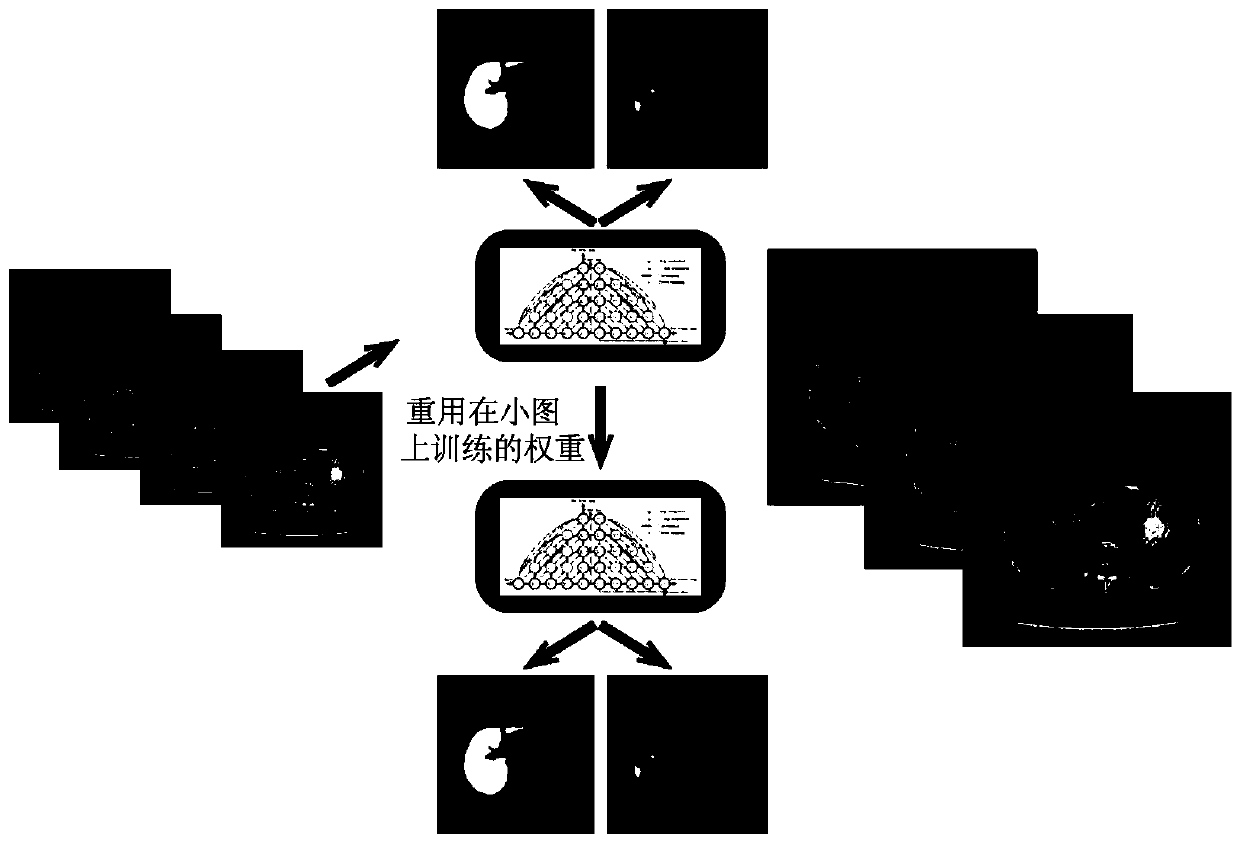 Method for segmenting liver and focus thereof in medical image