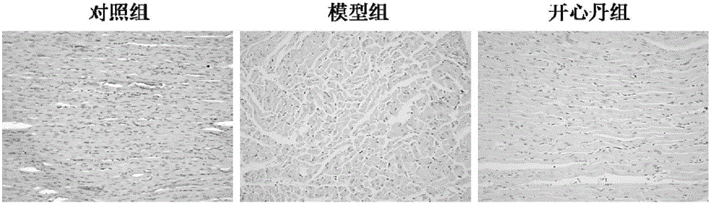 Pharmaceutical composition for preventing and treating myocardial ischemia and preparation method thereof