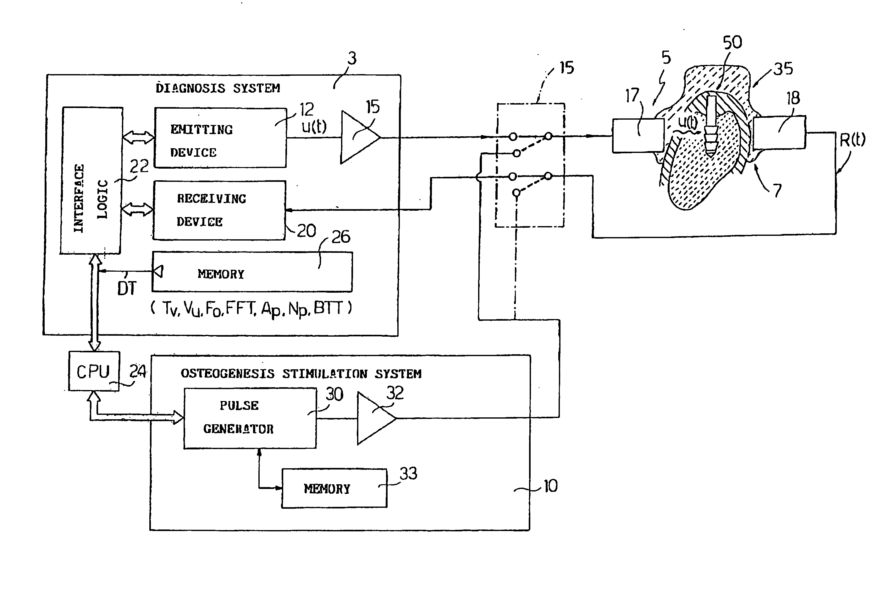 Electronic system for determining the density and structure of bone tissue and stimulating osteogenesis in dentistry