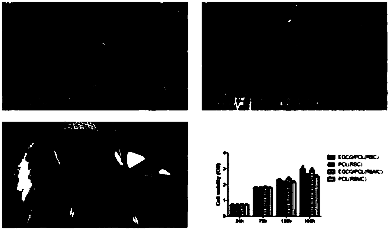 Melatonin nerve conduit composition and nerve conduit, as well as preparation method and application thereof