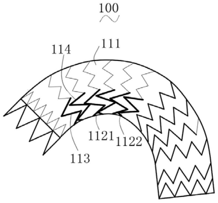 Stent Graft