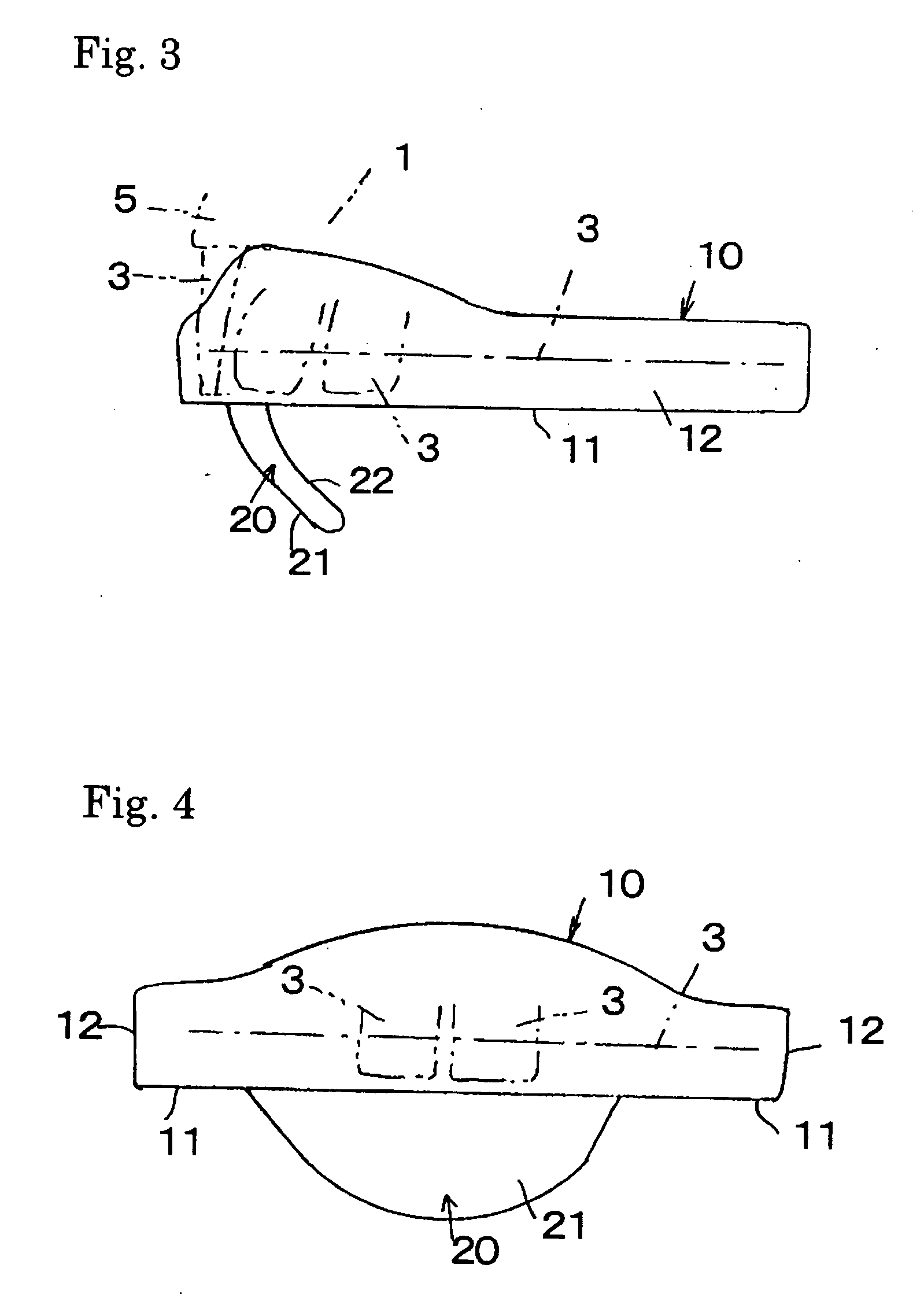 Snore and sleep apnea syndrome medical treatment device