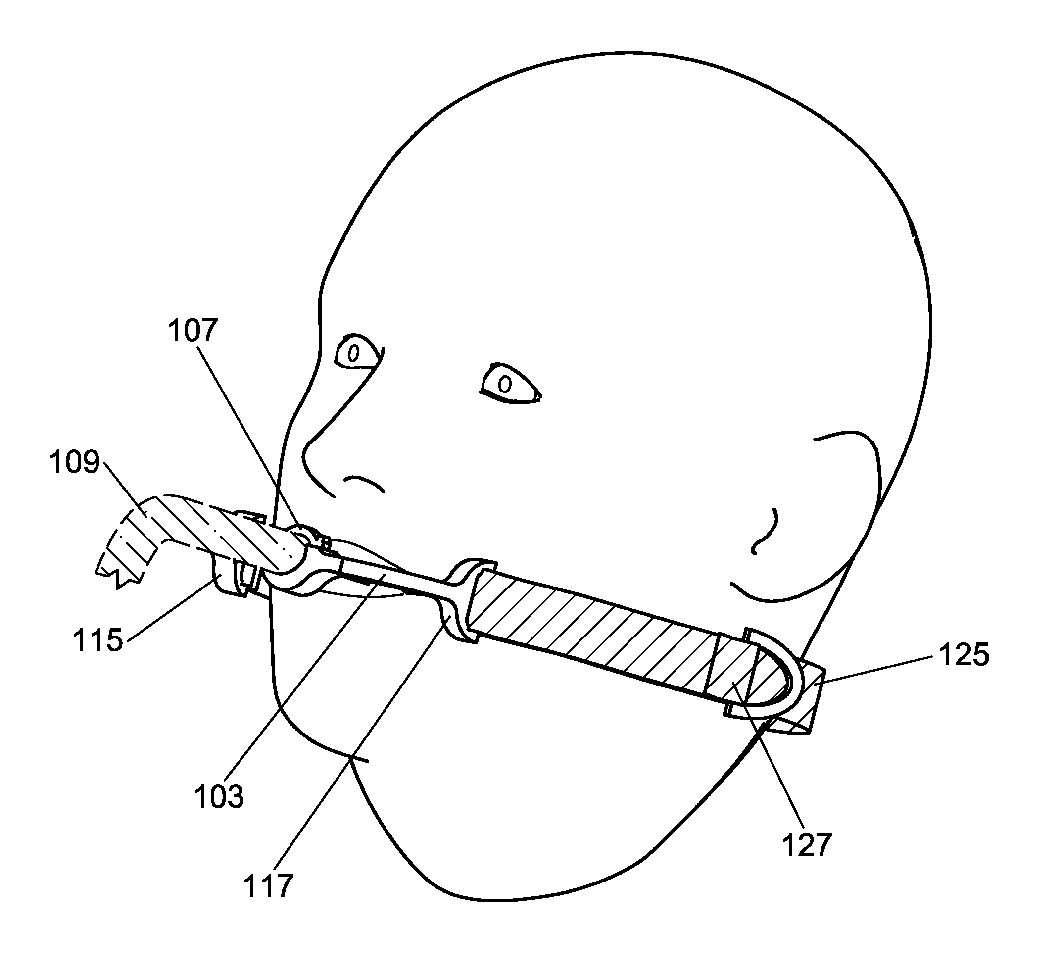 Endotracheal Tube Securement Device