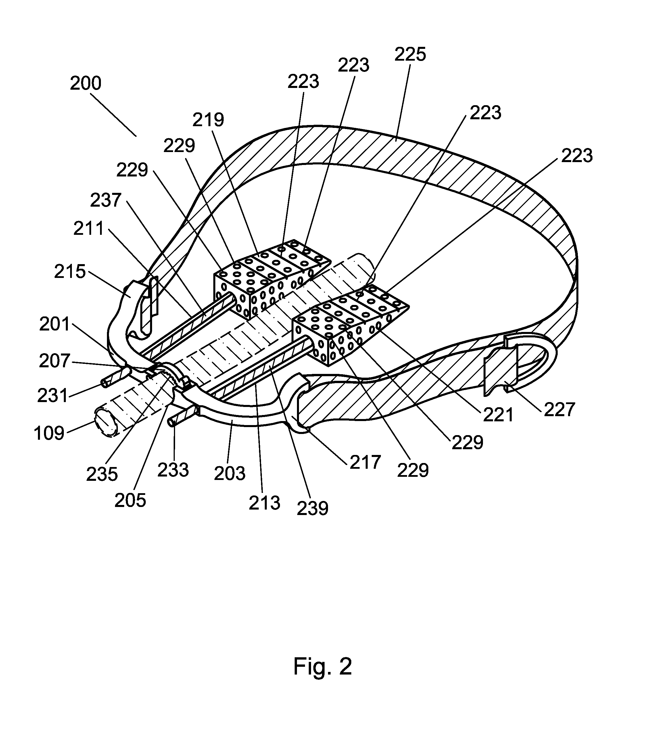 Endotracheal Tube Securement Device