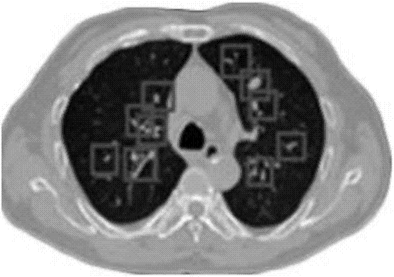 Multi-modality medical image identification method and device based on deep learning