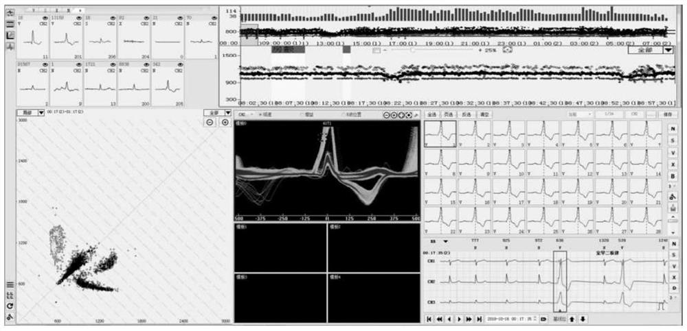 Full information display and analysis method for dynamic electrocardiogram analysis