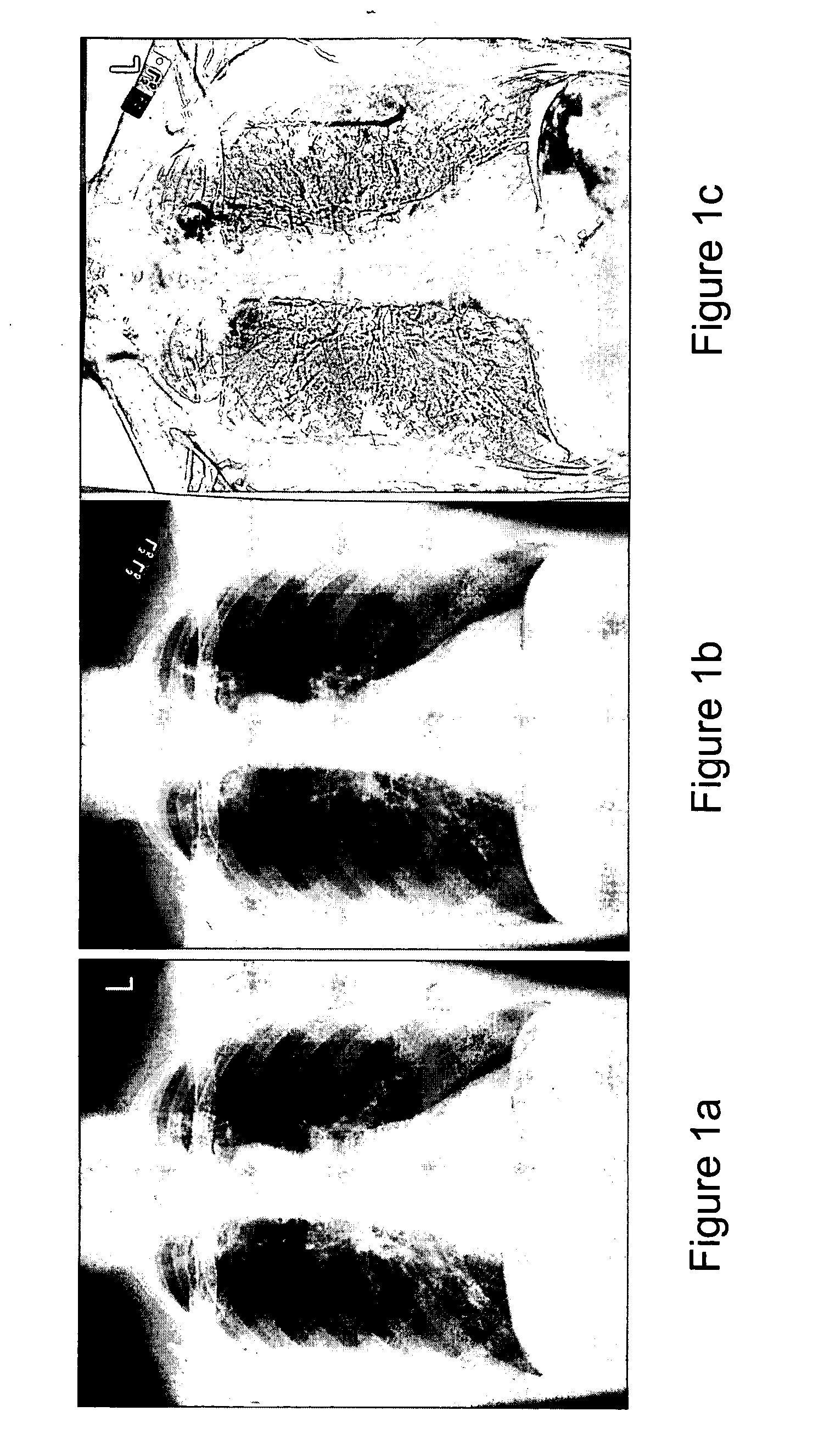 Automated method and system for the evaluation of disease and registration accuracy in the subtraction of temporally sequential medical images