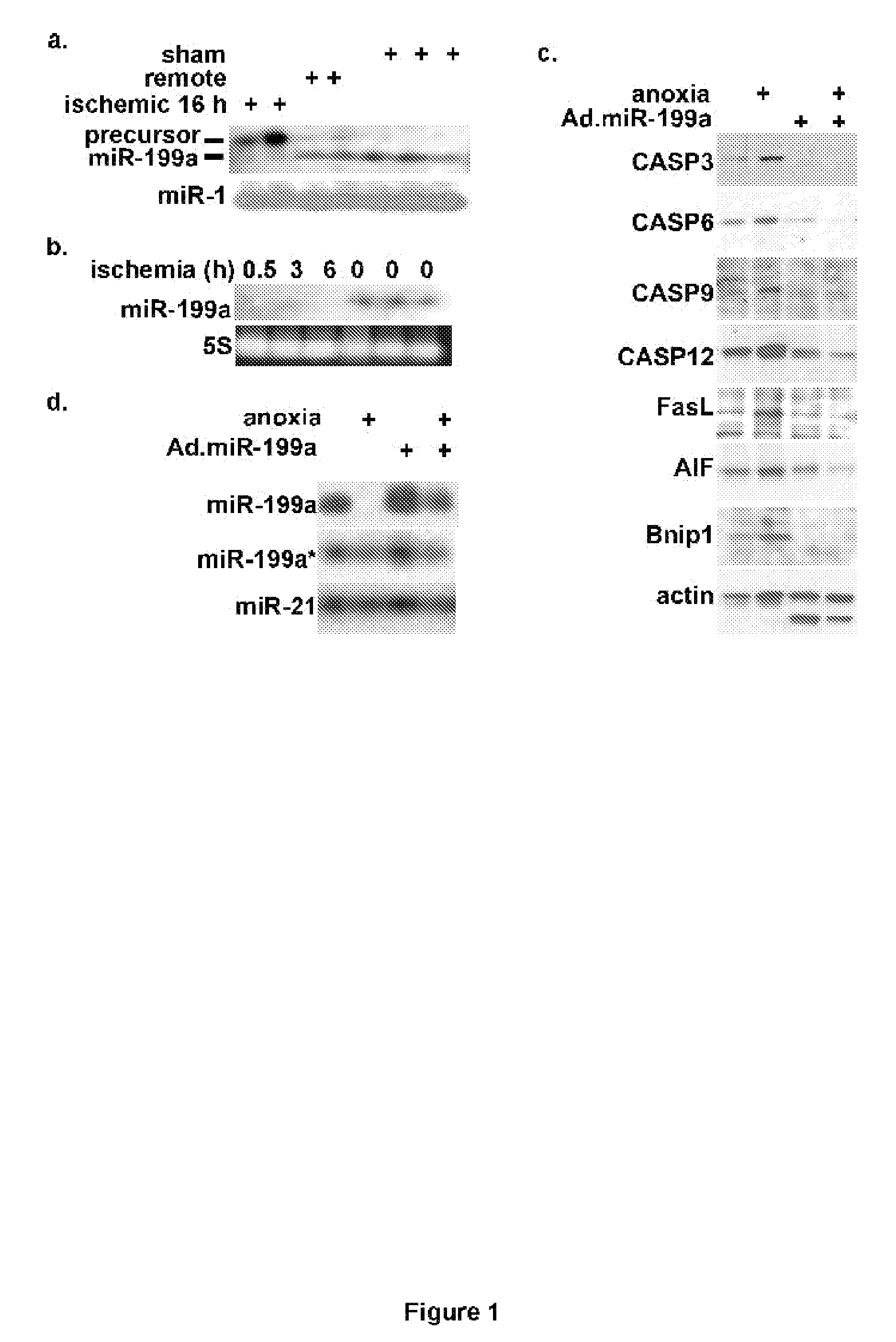 Anti-sense microrna expression vectors