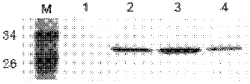 Anthropogenic LMP1 (latent membrane protein1) extracellular regional antibody for nasopharyngeal carcinoma and application thereof