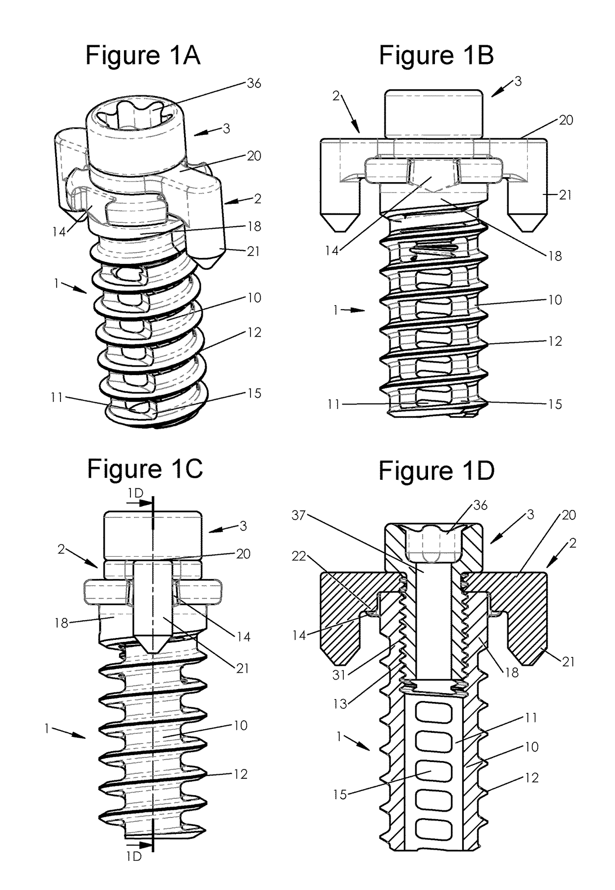 Bone implants