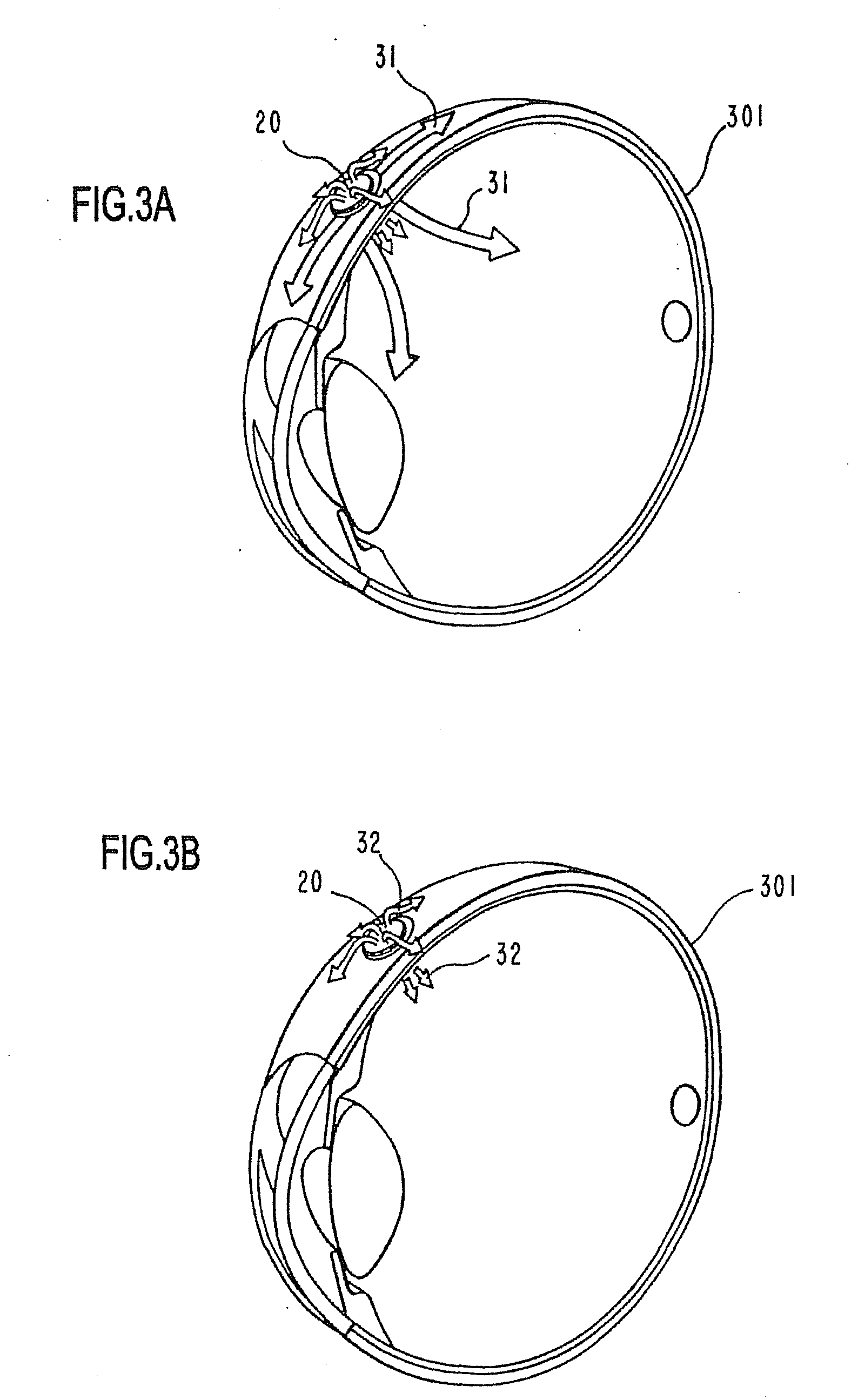 Ocular therapeutic agent delivery devices and methods for making and using such devices