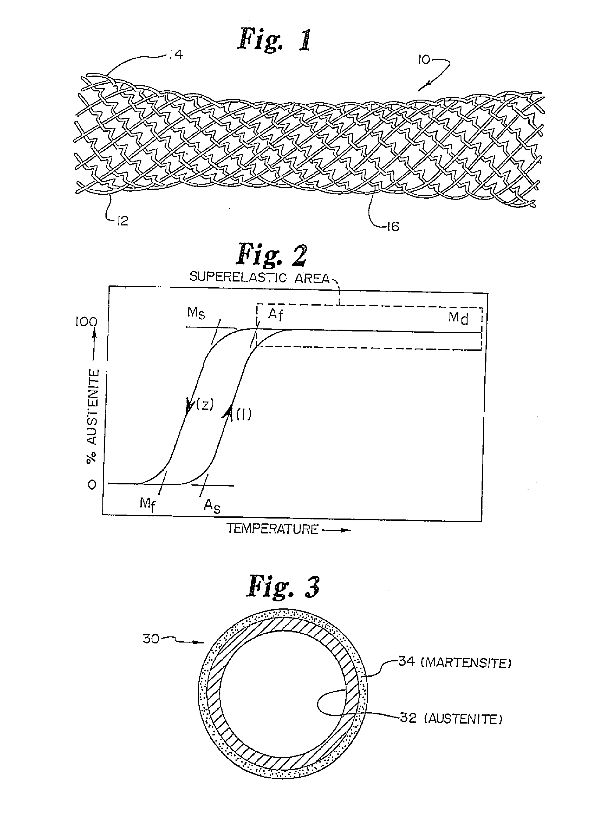 Improved tissue supporting devices