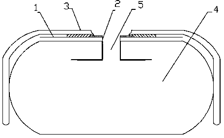 Abdominal laparotomy surgery combined pasting membrane