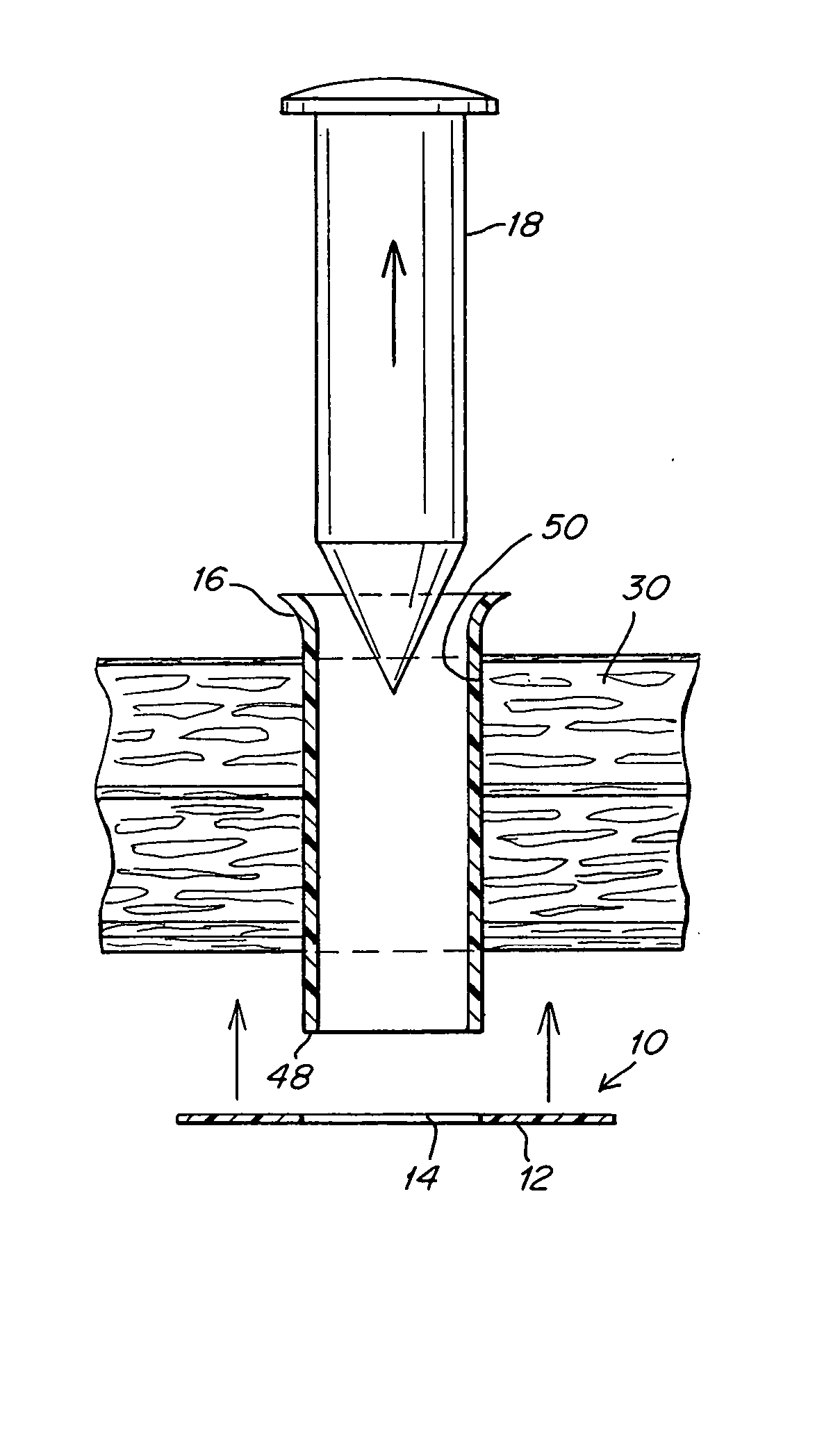 Implantable prosthesis and method of use