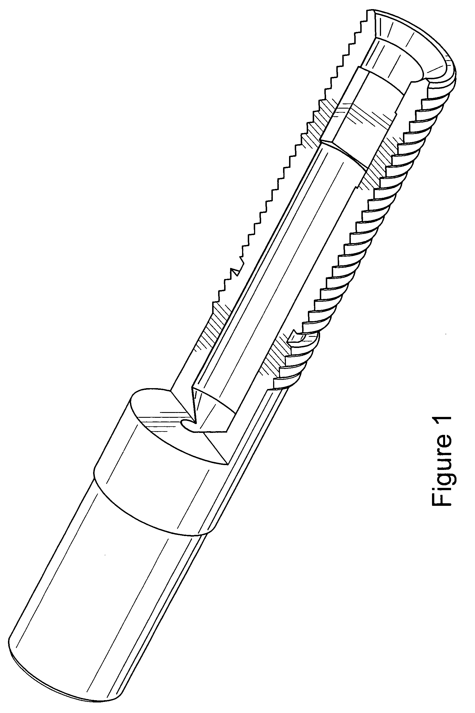 Disengagement and removal tool for swollen glow plug