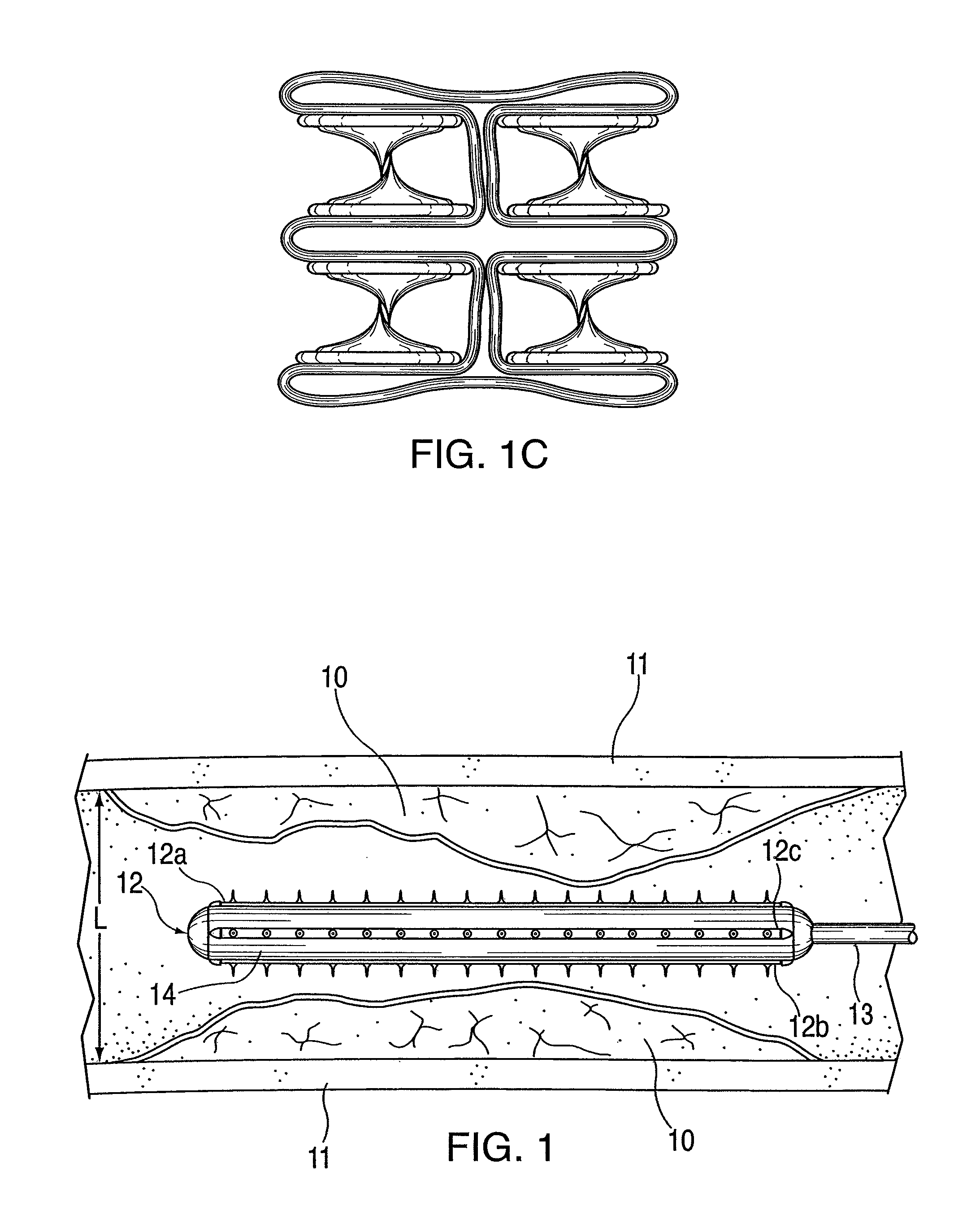 Intravascular device