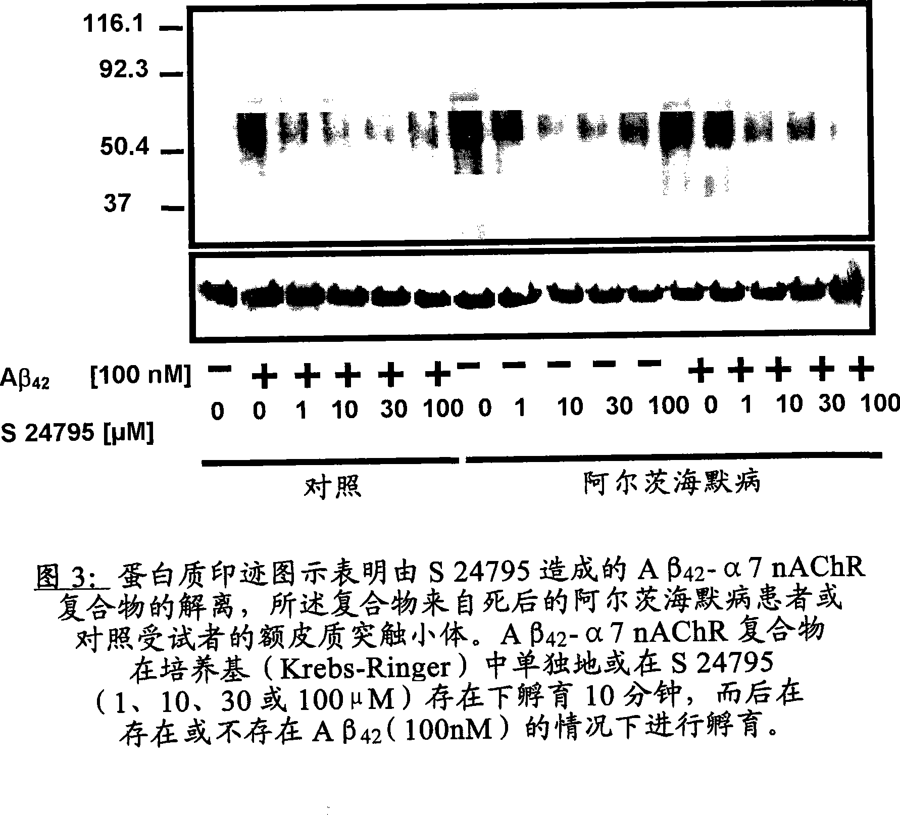 Method of screening for compounds with anti-amyloid properties