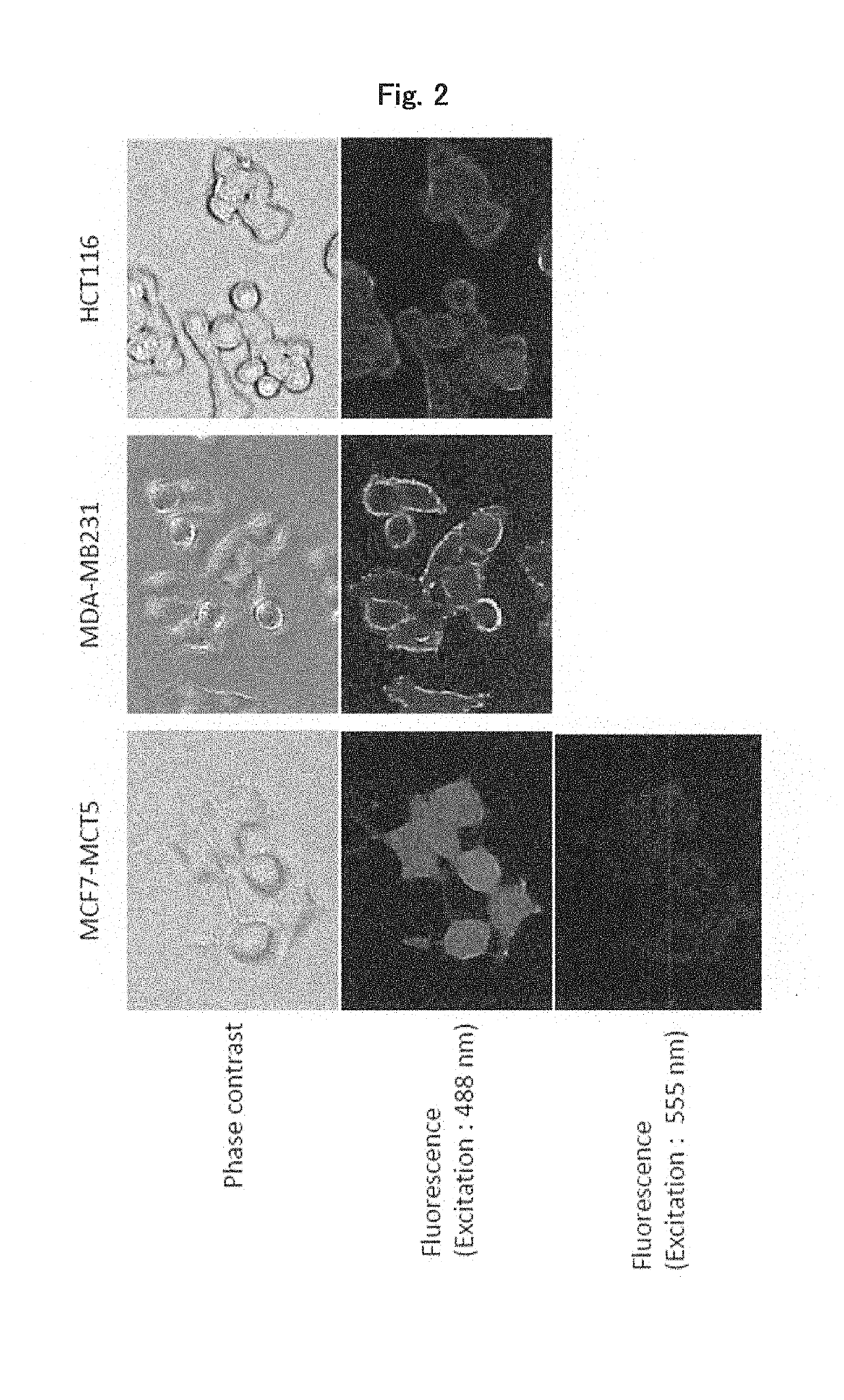 Cancer treatment pharmaceutical composition using Anti-mct5 antibody