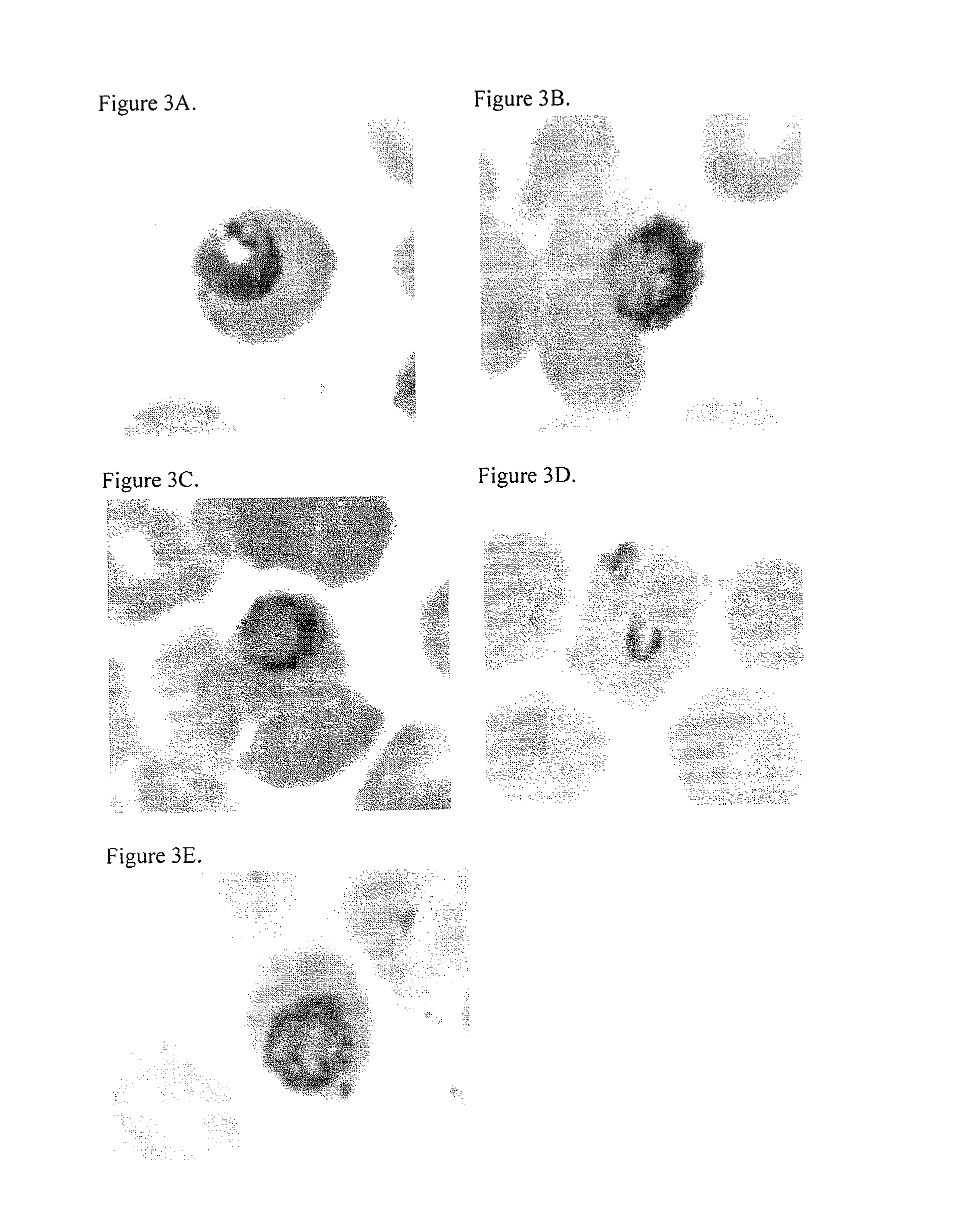 Prodrug compositions and methods for using the same in treating cancer and malaria