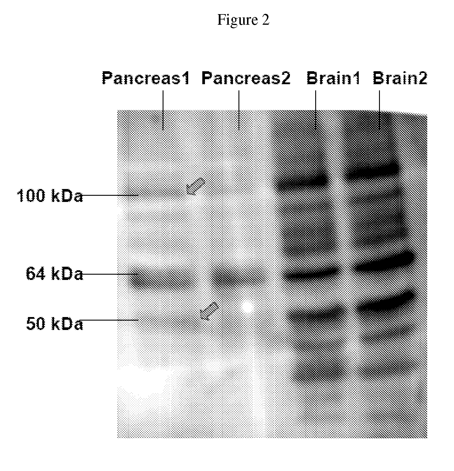 Methods and compositions for preventing and/or treating pancreatitis