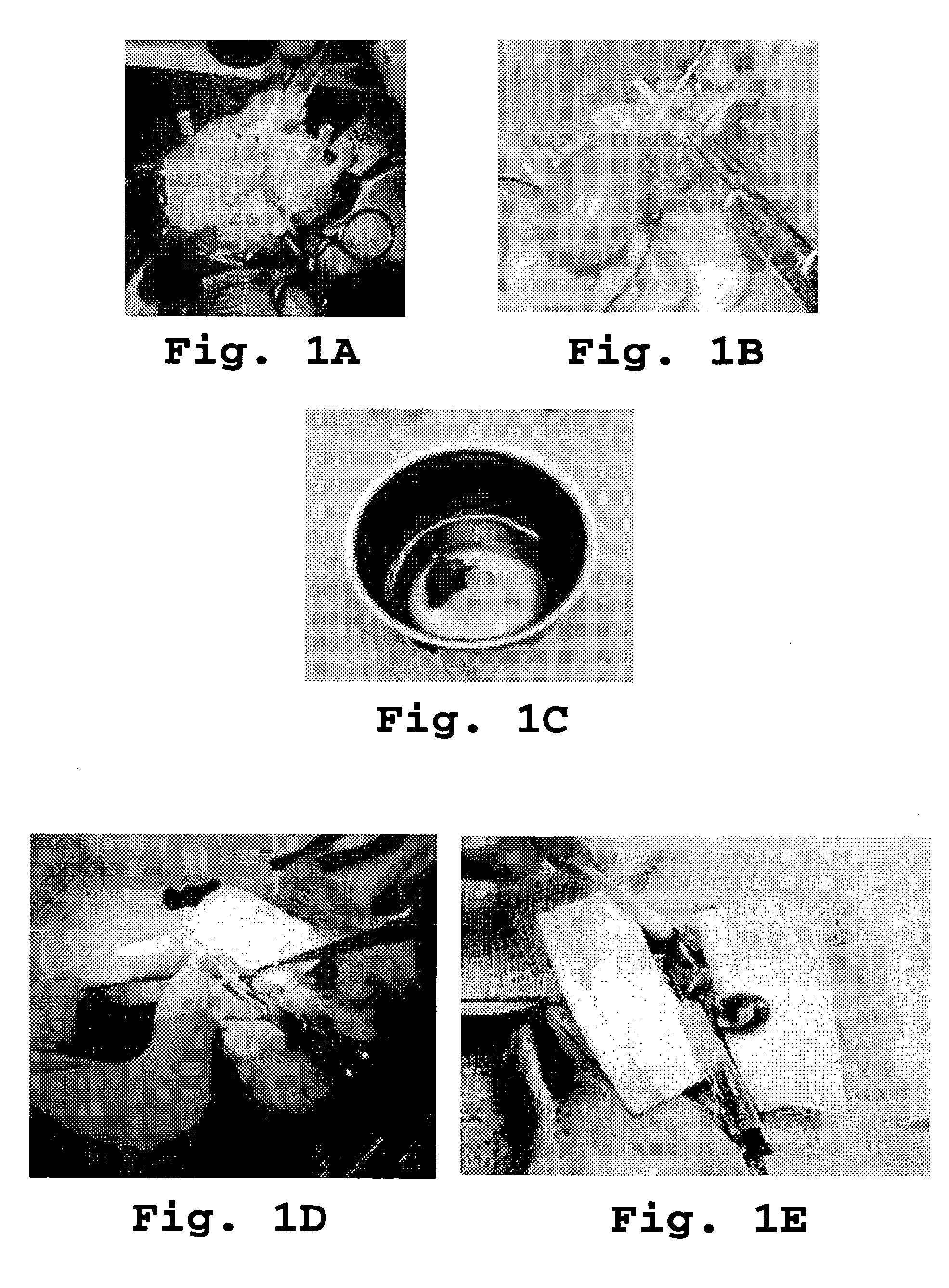 Methods and compositions for reducing injury to a transplanted organ