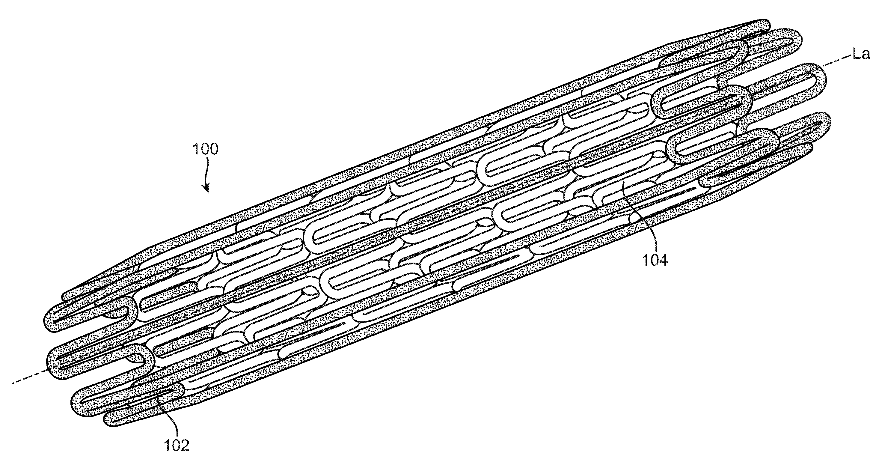 Double-Walled Stent System