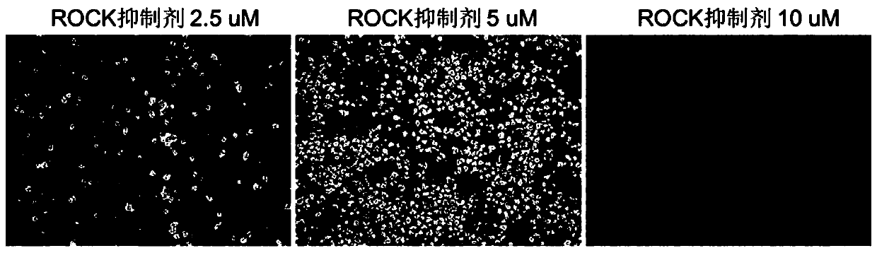 Mesenchymal stem cell, and preparation method and application thereof