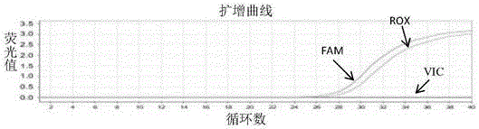 Method and kit for detecting ADRB1 gene single nucleotide polymorphic site