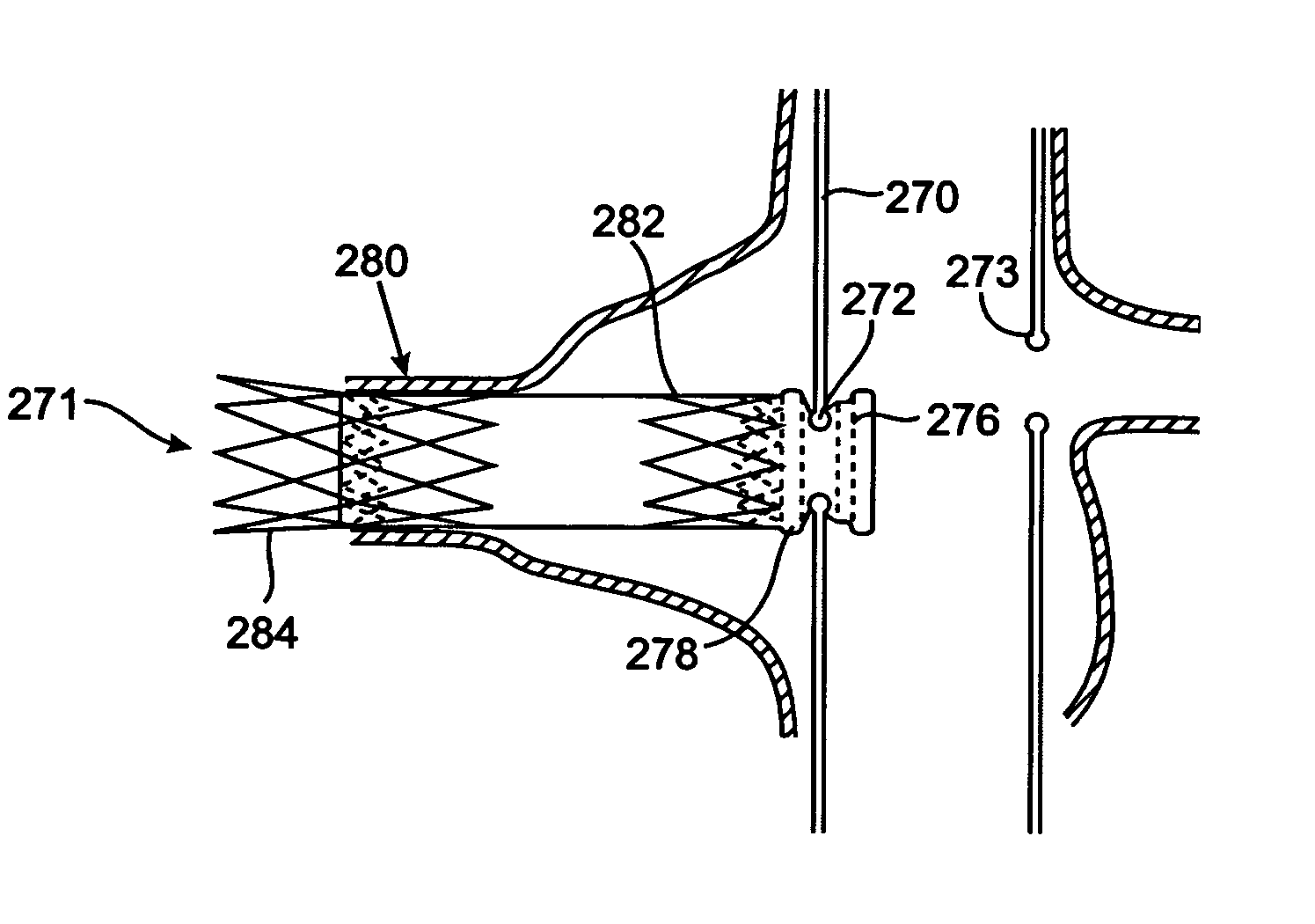 Branch vessel graft design and deployment method