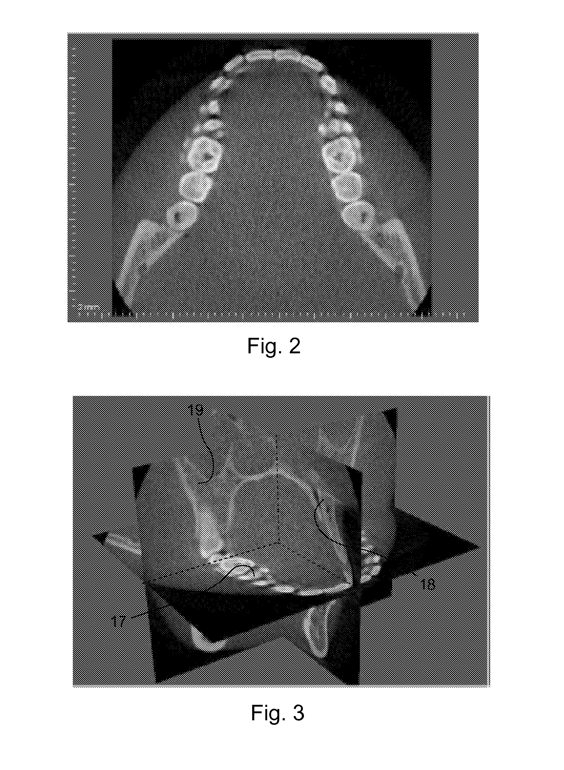 Method for the reconstruction of a panoramic image of an object, and a computed tomography scanner implementing said method