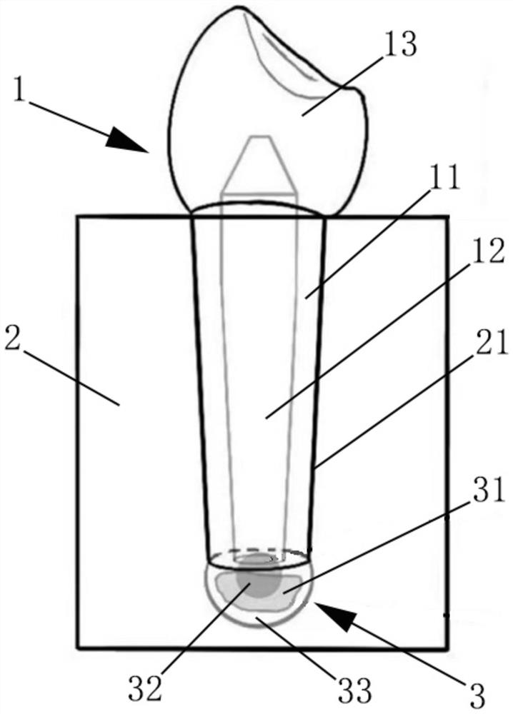 Diseased tooth model for simulating root canal barrier surgery in vitro as well as construction method and application of diseased tooth model