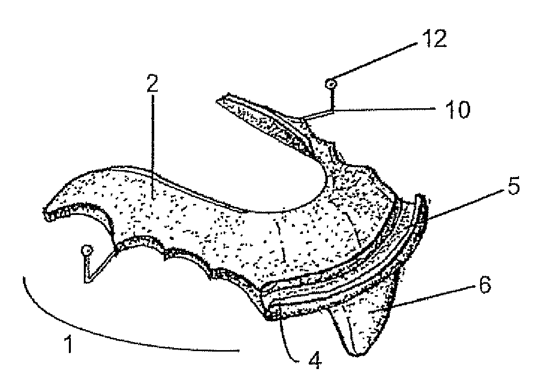 Intraoral mandibular advancement device for treatment of sleep disorders