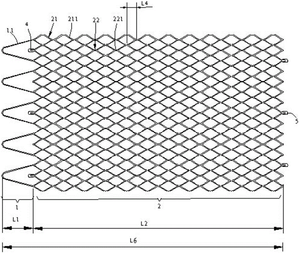 Intravascular stent and preparation method and application thereof