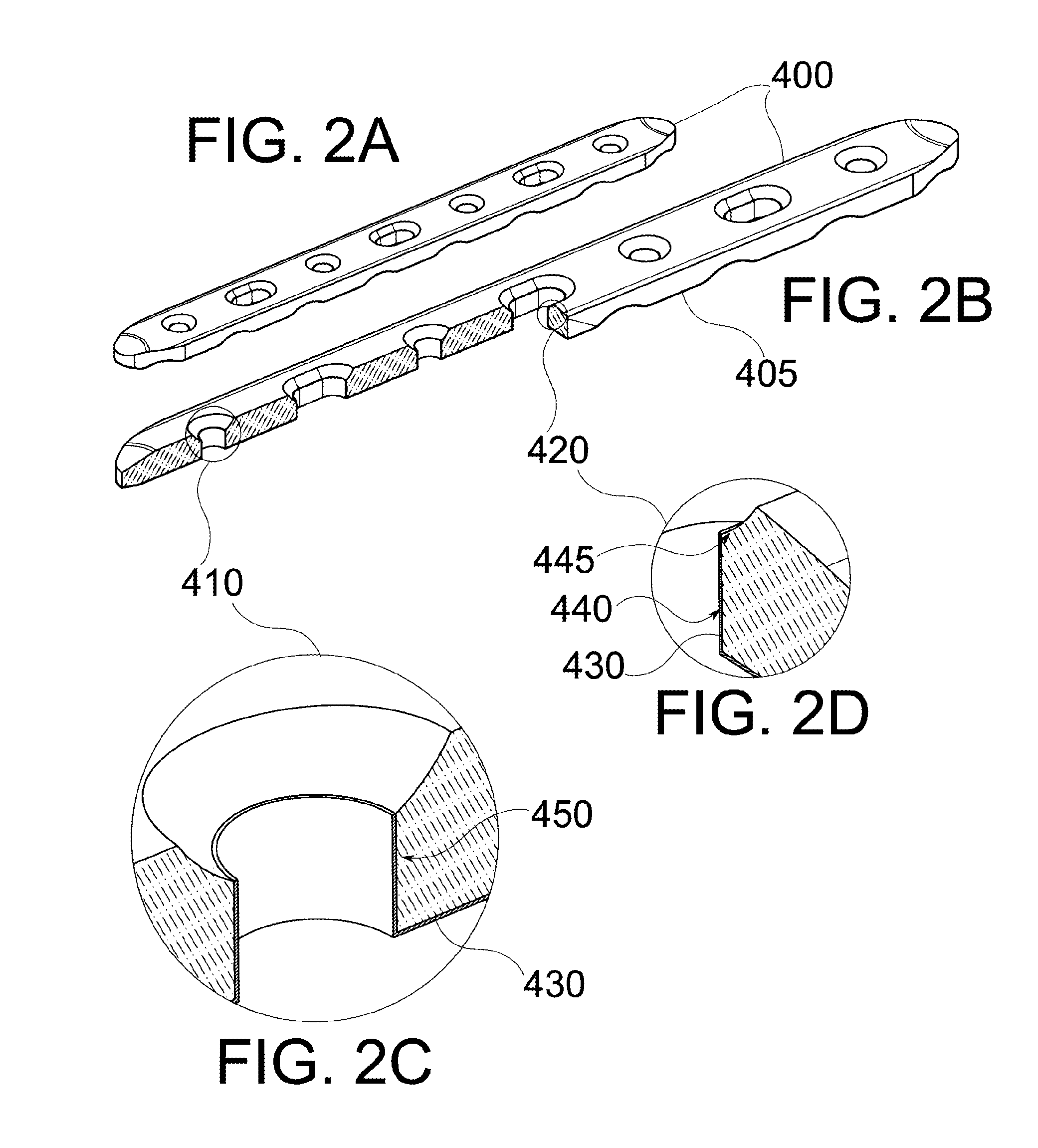 Composite implant coating