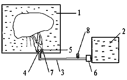 In vitro continuous filling device used for autologous liver transplantation