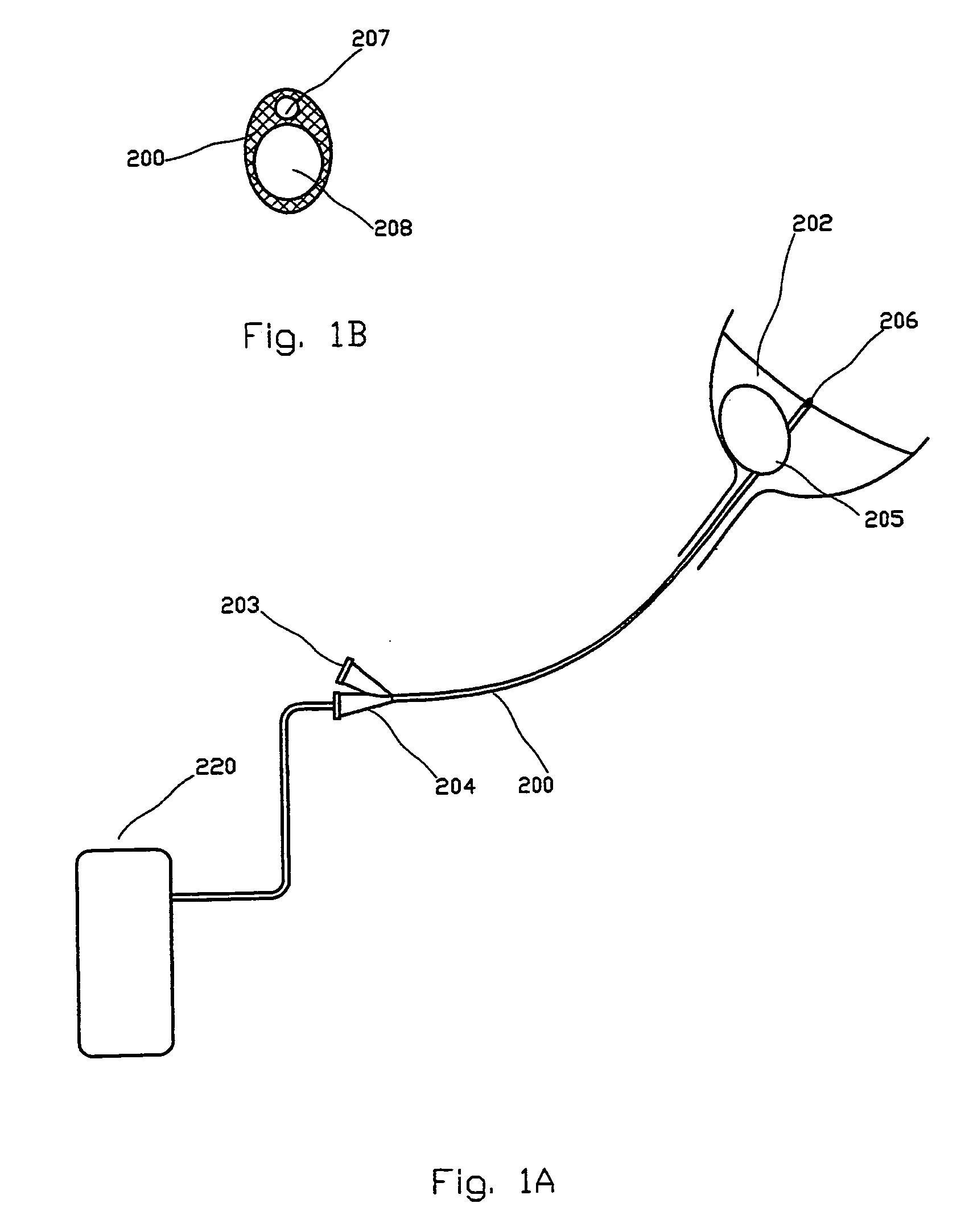 Method, apparatus and system for treating biofilms associated with catheters