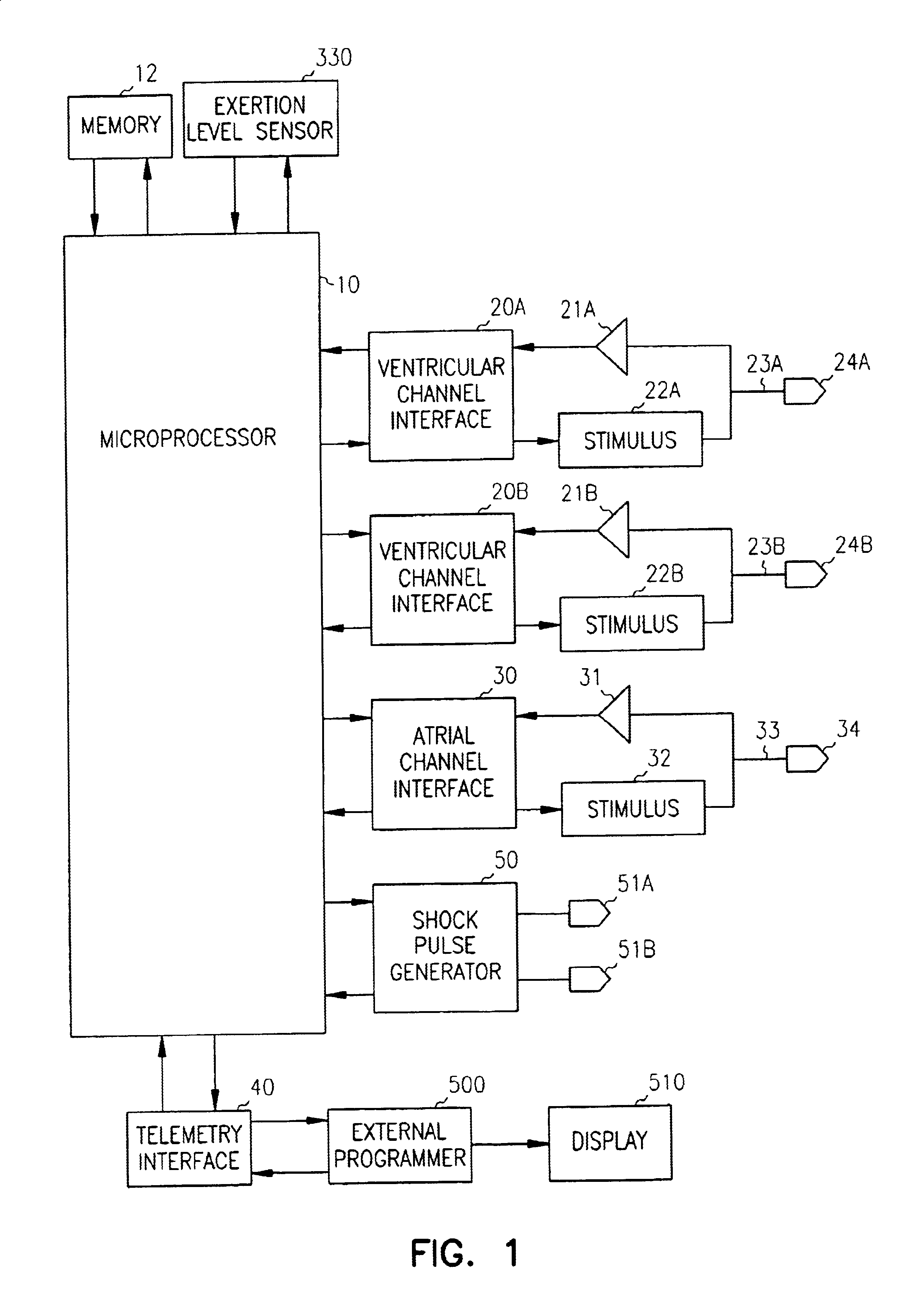 Apparatus and method for multi-site anti-tachycardia pacing