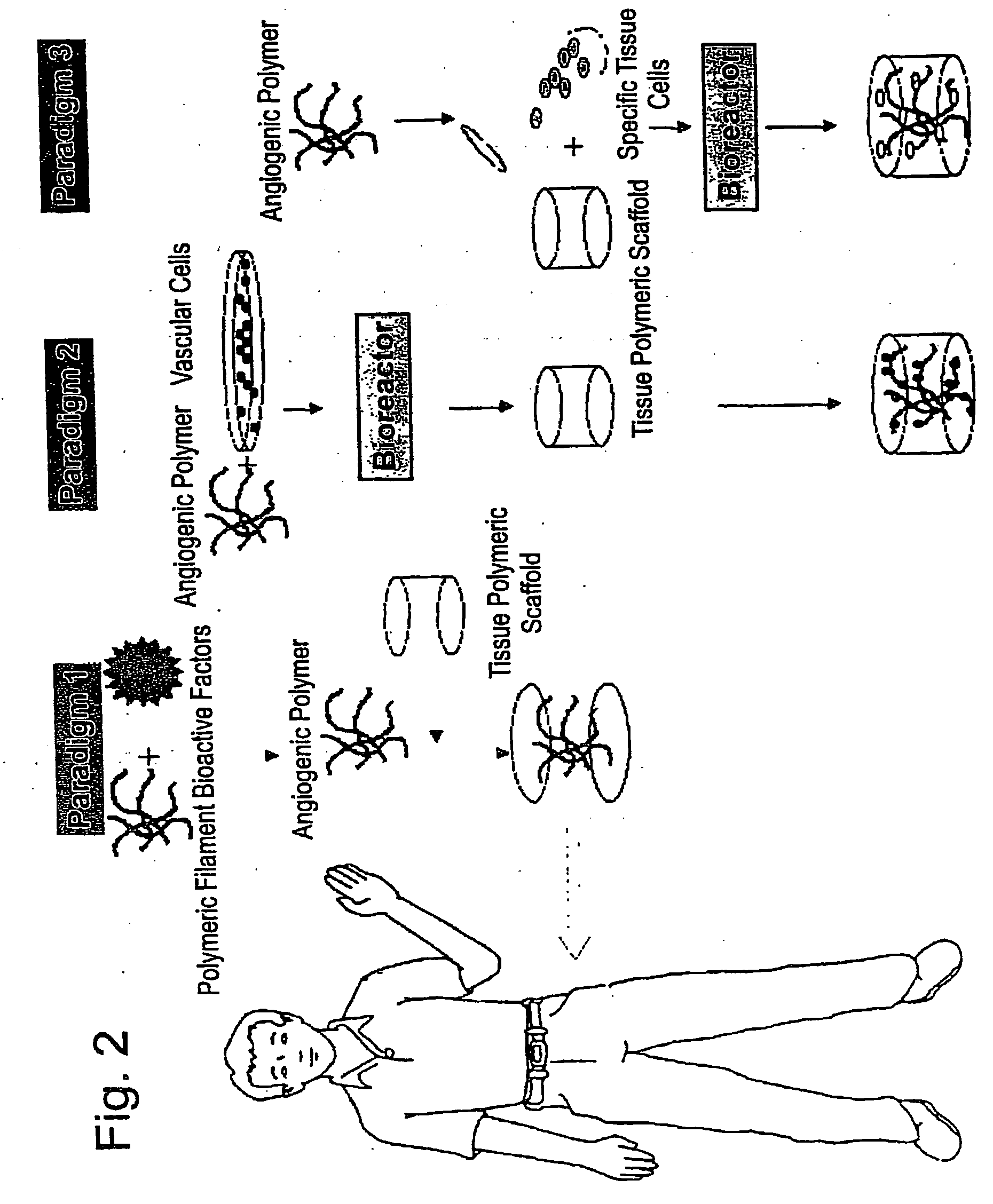 Composite scaffolds and methods using same for generating complex tissue grafts