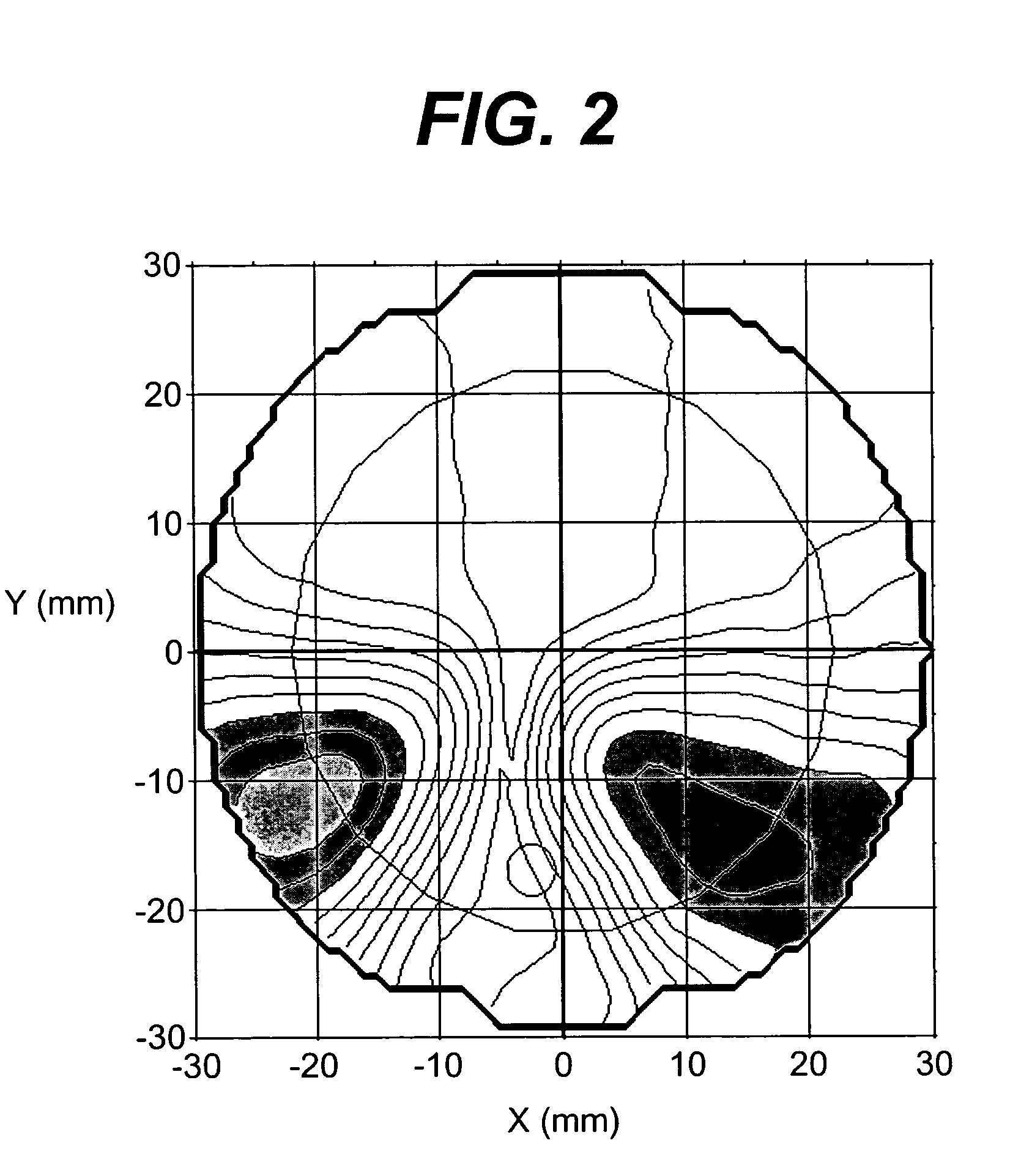 Progressive addition lenses with an additional zone