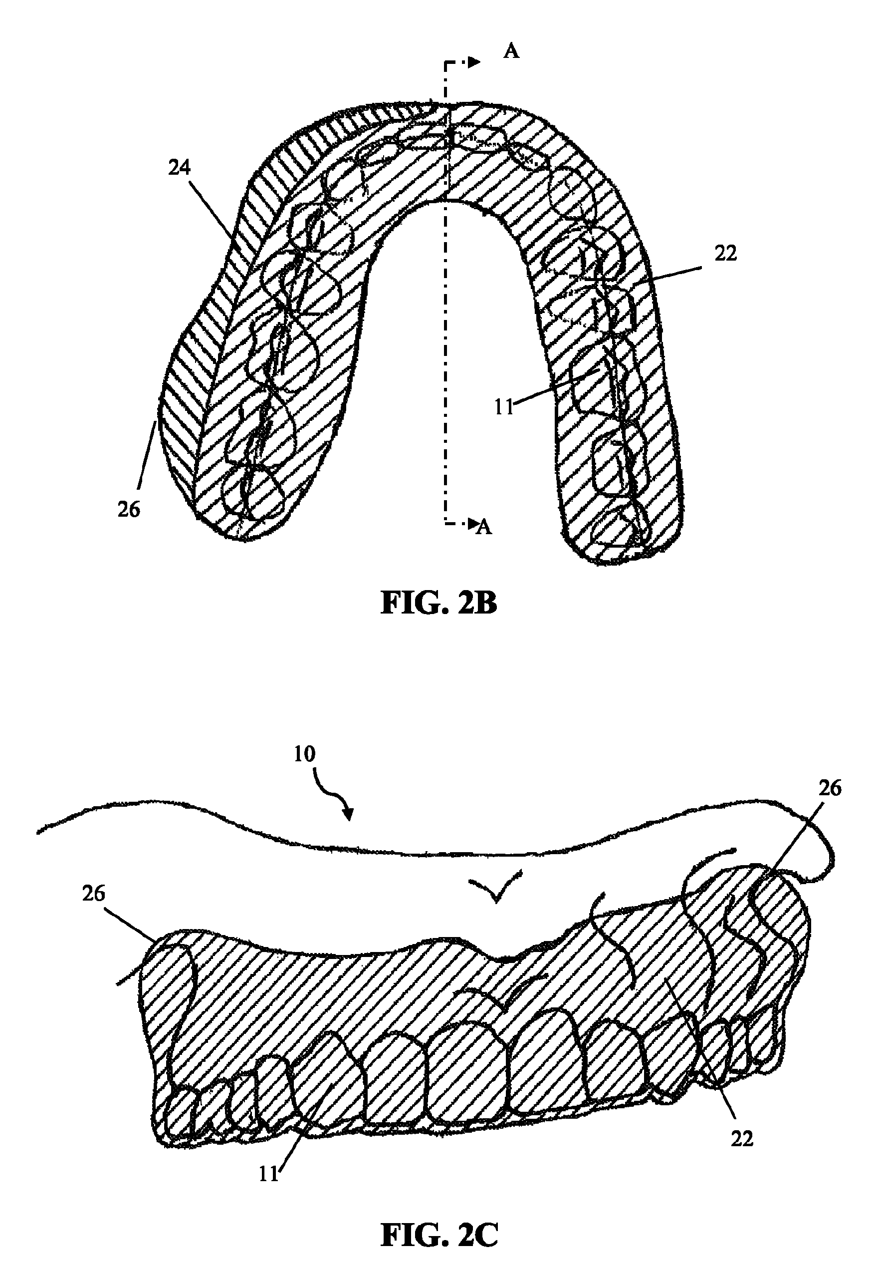 Intra-oral appliance and methods of using same