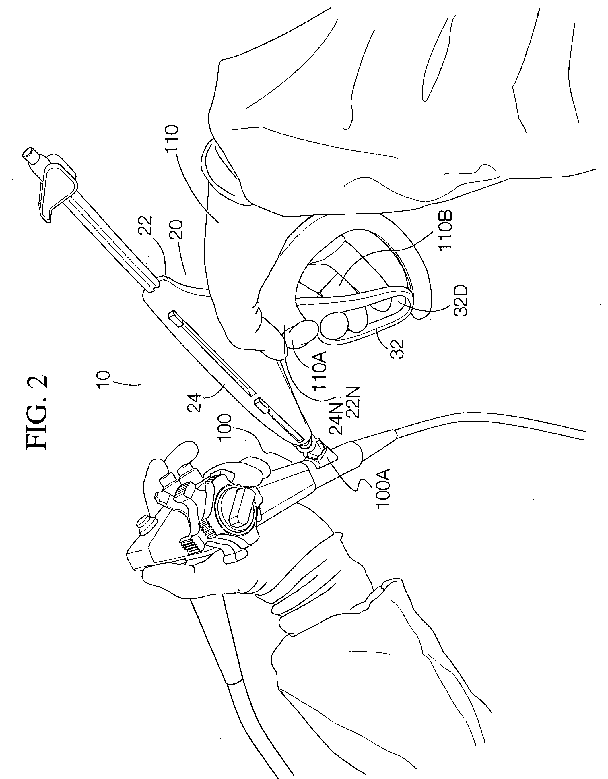 Ergonomic needle tissue harvesting instrument not requiring a stylet