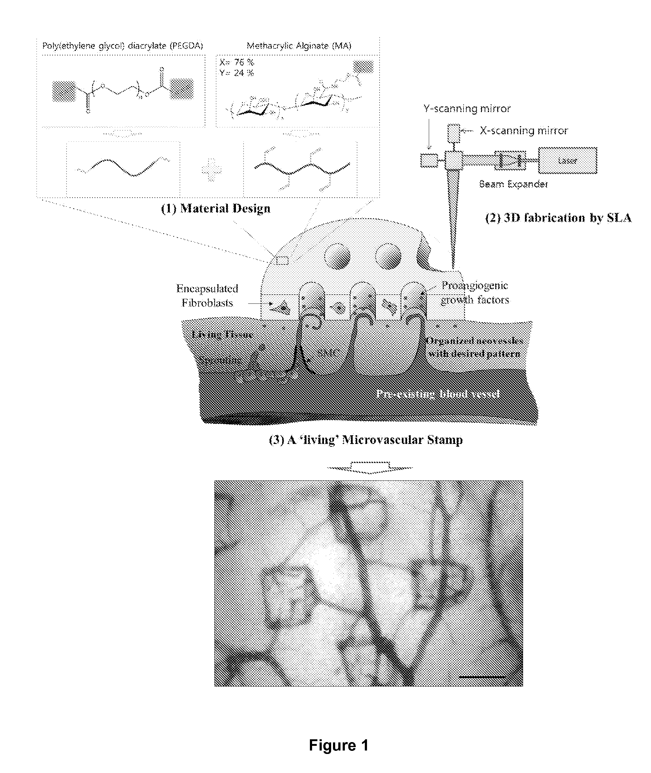 Microvascular stamp for patterning of functional neovessels