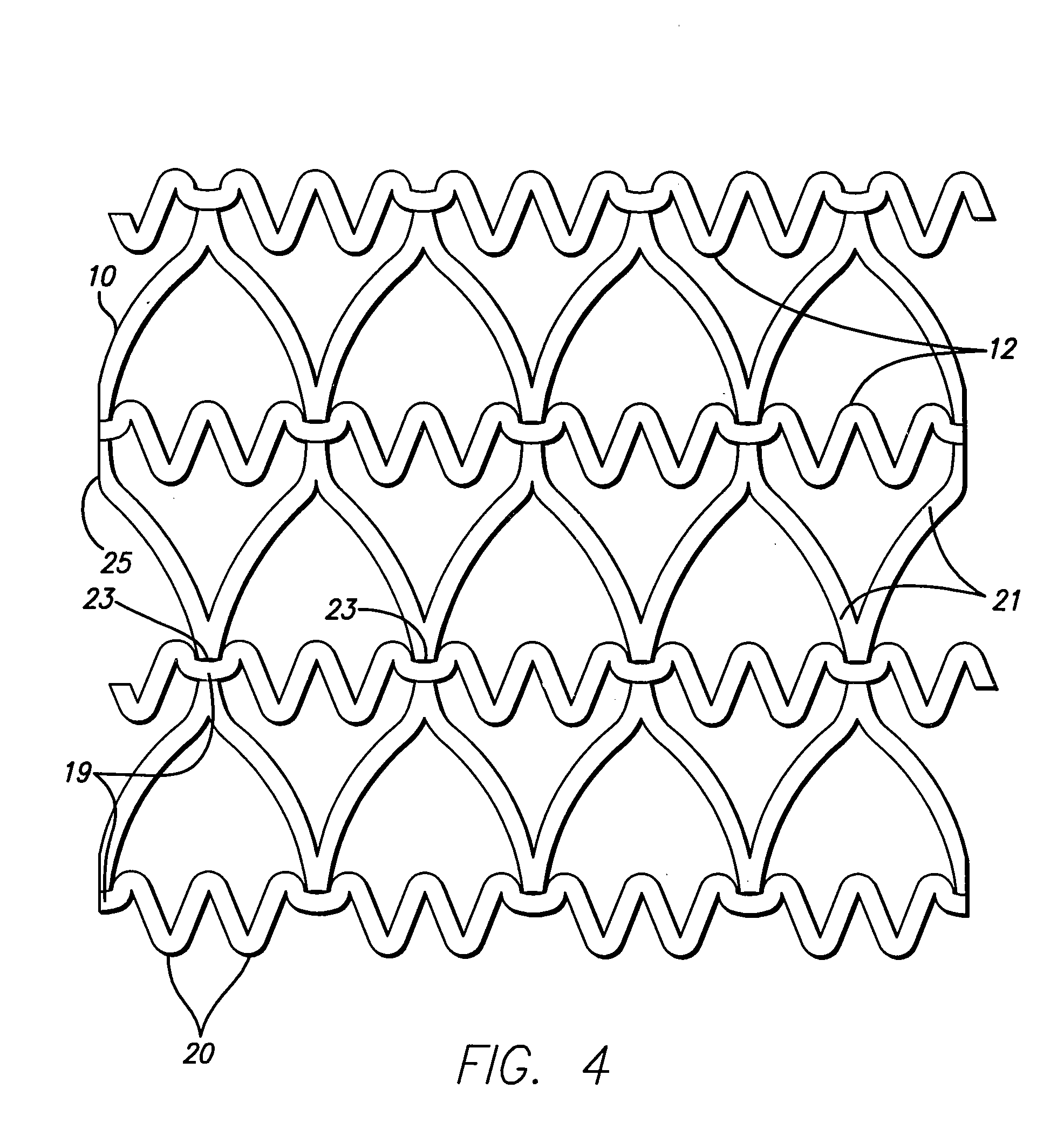 Hybrid stent and method of making