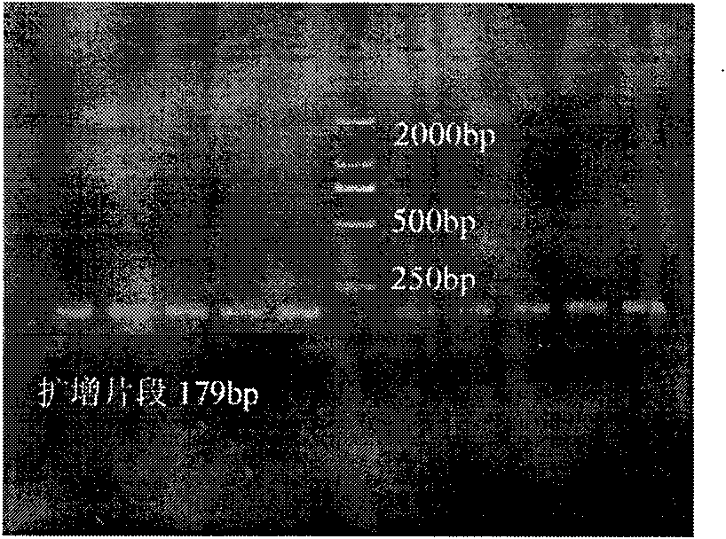 Method for breeding lean-type Chinese Huai pigs in multi-gene pyramiding manner based on growth traits thereof